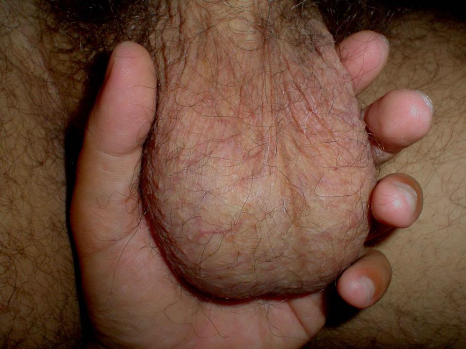 Large balls to lick